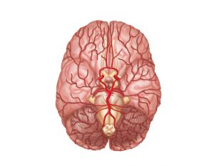 Cerebrovascular Disease